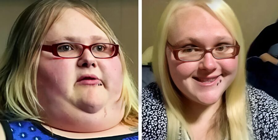 This young woman weighed 240 kg at 24 years old, and here’s what she looks like today after losing 147 kg